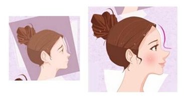 怎么填充额头？