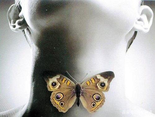 甲状腺肿大能治愈吗