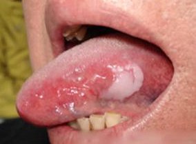 牙痛有哪些治疗方法？