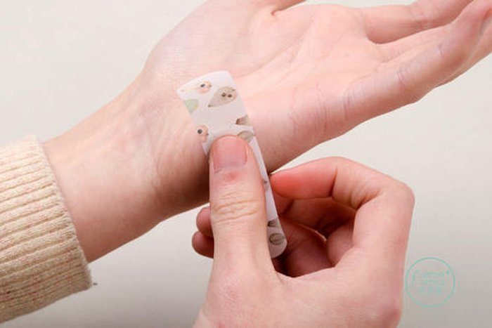 伤口是如何进行自我修复的？