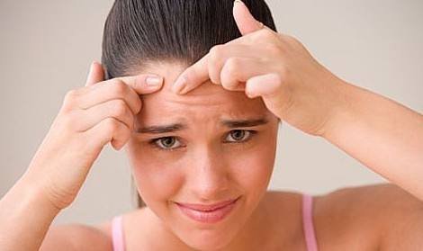 青春痘怎么去除？