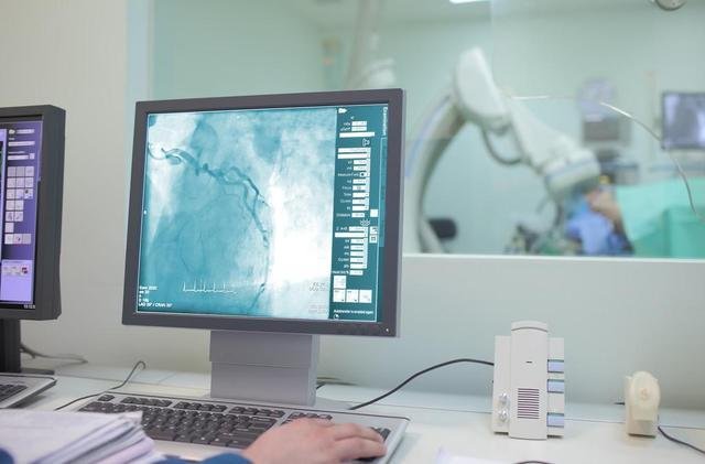 做心脏造影多少钱?