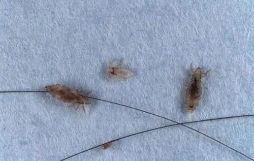 东莞一女儿被妈妈用农药焗头驱虱进ICU，她女儿究竟怎么了？