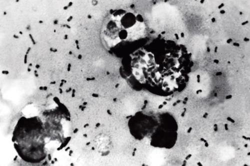 内蒙古57个旗县鼠疫风险地图，现在的鼠疫情况怎么样了？