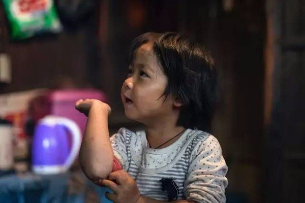 香港大头怪婴事件到底是怎么回事？