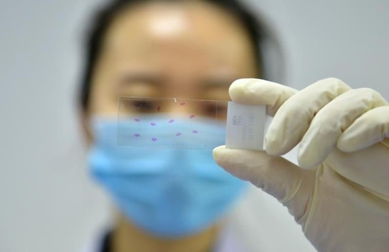 核酸检测结果多久同步到健康码上12-24小时出结