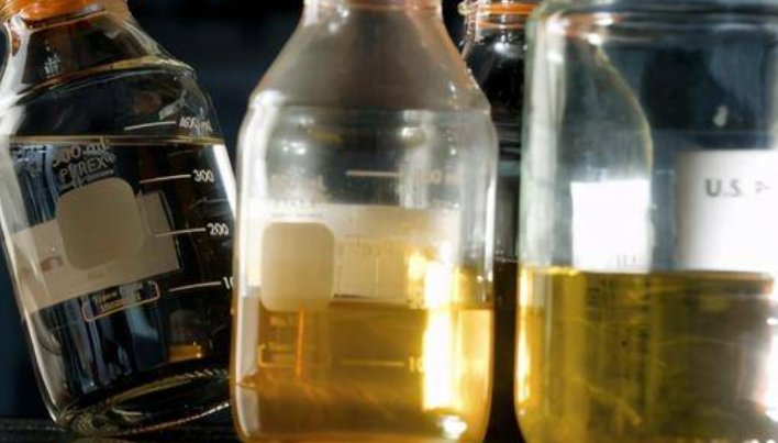 有人收购孕妇尿液，专家：可用于验孕试纸和制药，尿液真的可以卖钱？