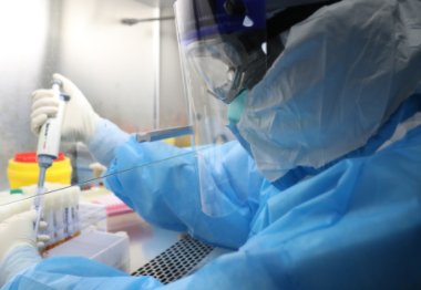 意大利男子生前毫无新冠症状,死后连续28次阳性,究竟是如何感染的呢?