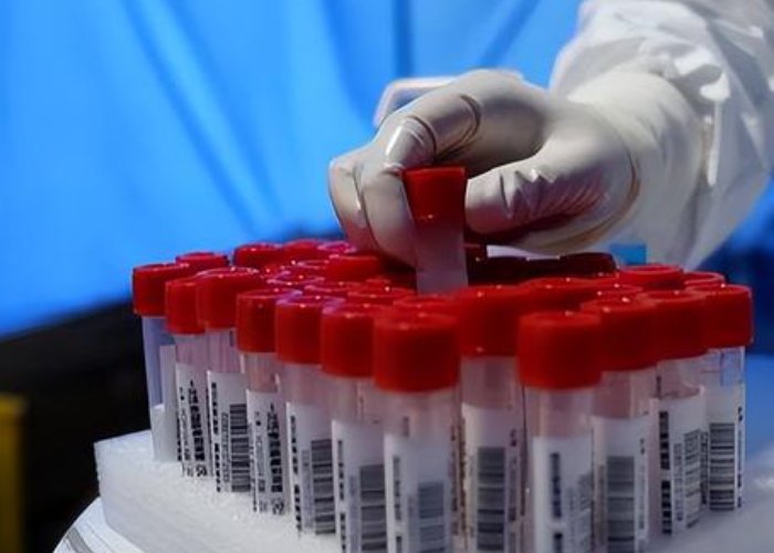 成都常态化核酸不再免费，这会给当地居民生活带来哪些变化？