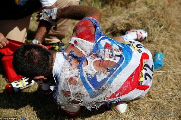 血肉模糊的近义词