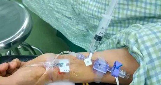 东北女子麻醉的药性还没有过去，躺在病床上就开始劝酒，她都说了什么？