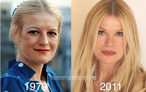 辛迪·杰克逊的整容原因