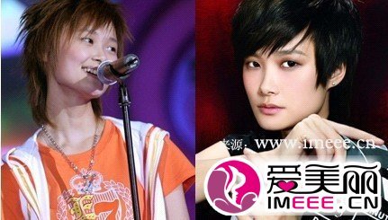 李宇春整容死的介绍