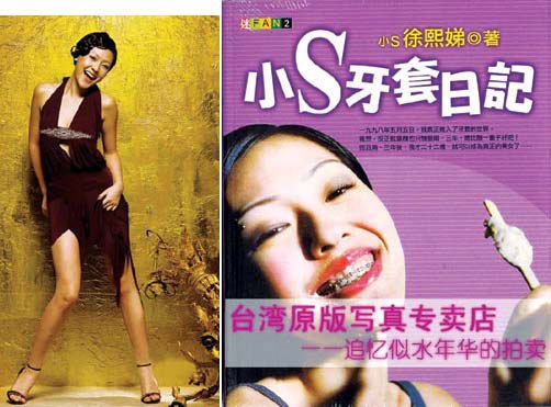 小S牙套日记的介绍