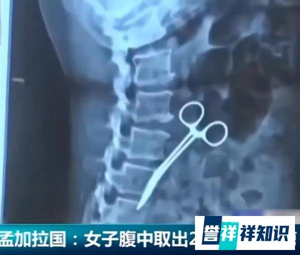 52岁李嘉欣进ICU抢救，险成植物人：别再糟蹋身体了，真的耗不起！