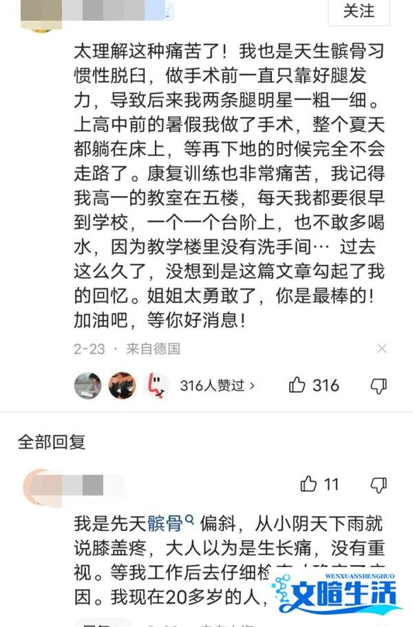 心疼,天后李玟自爆左腿先天缺陷,病情严重已无法正常走路