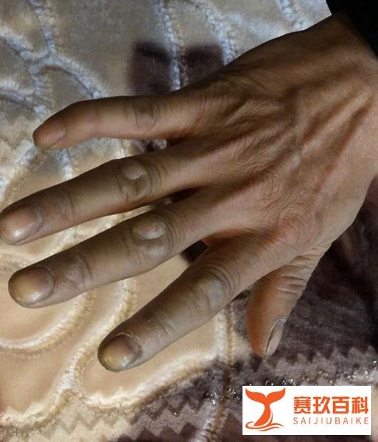 重庆被砸艺考生父母选择原谅：我的女儿能回来吗 我愿意放下 未来的路还很长