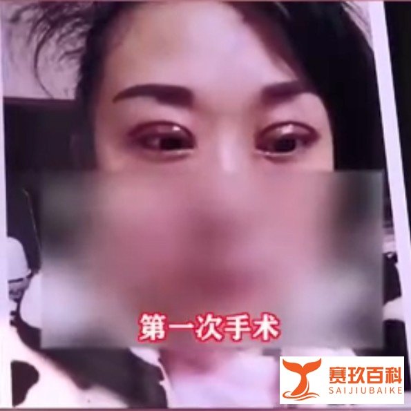 如何看待热搜“双眼皮失败老公闹离婚”?