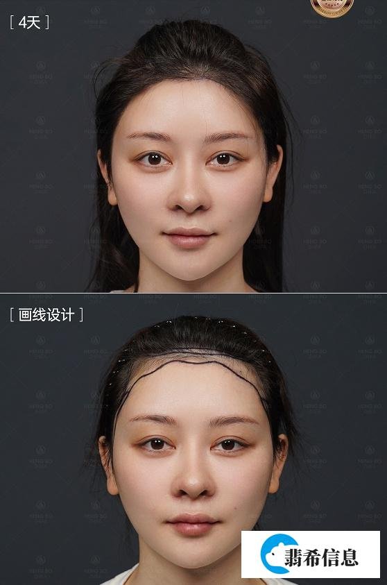 大佬说找工作不要挑肥拣瘦了「毕业生先就业再择业，不要挑肥拣瘦」