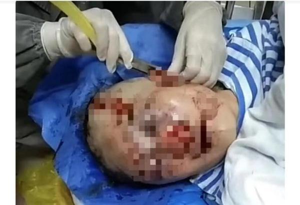 浙江永康一女子公厕遭暴打！更多细节曝光，警方：嫌犯要精神鉴定