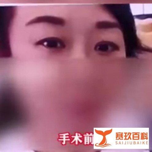 如何看待热搜“双眼皮失败老公闹离婚”？