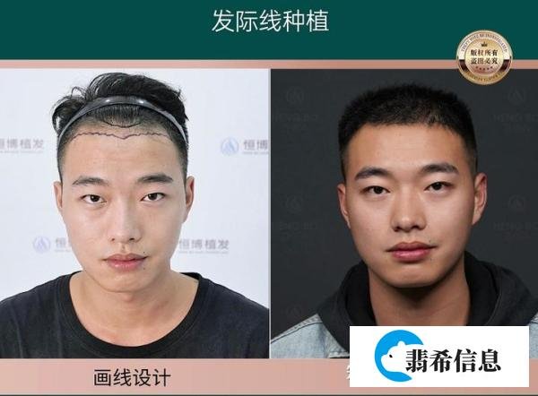 大佬说找工作不要挑肥拣瘦了「毕业生先就业再择业，不要挑肥拣瘦」