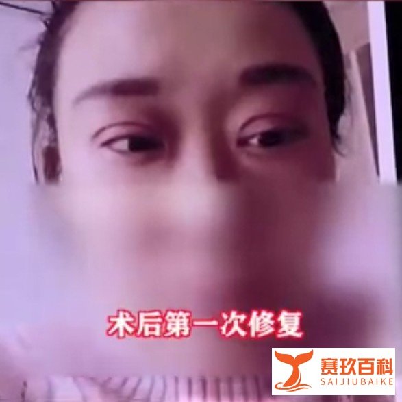 如何看待热搜“双眼皮失败老公闹离婚”?