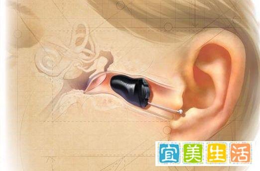 超小型助听器是什么