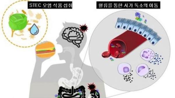 【中韩双语新闻】登上韩国热搜的“ 汉堡病 ”是什么来的？科学家的“黑科技”来了！