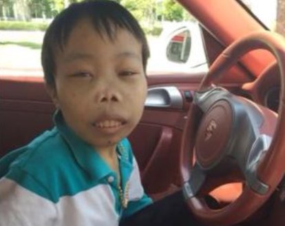 还记得“外星人”陈山吗？封杀3年变化巨大，如今生活过得怎样了？