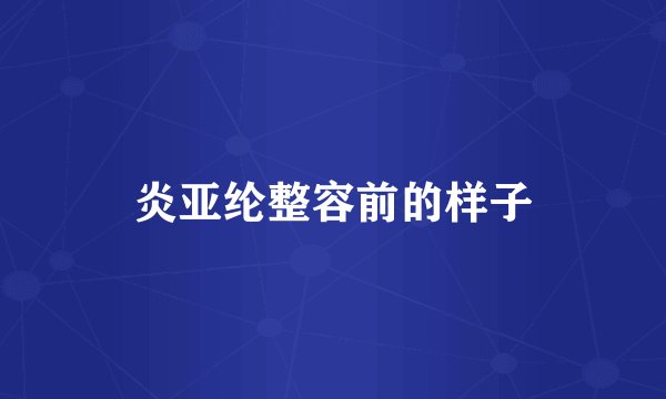炎亚纶整容前的样子
