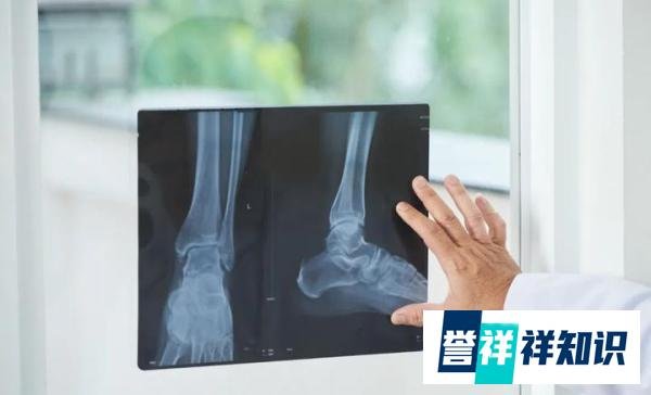 北京积水潭医院院长田伟被抓！医疗反腐最为重磅的新闻来了