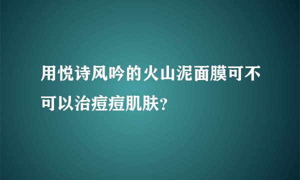 用悦诗风吟的火山泥面膜可不可以治痘痘肌肤？