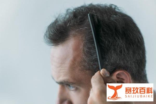最强大脑天才俞辰捷是如何保持发量不减少的？