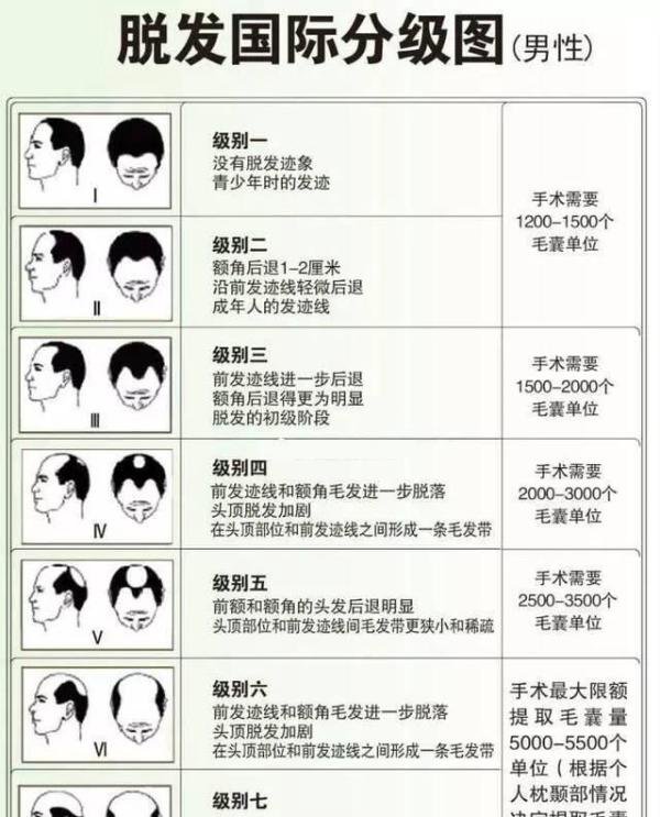 2024植发价格大跳水,2000、3000毛囊单位分别需要多少钱?附今年最新价格表(植发价格实时更新)!