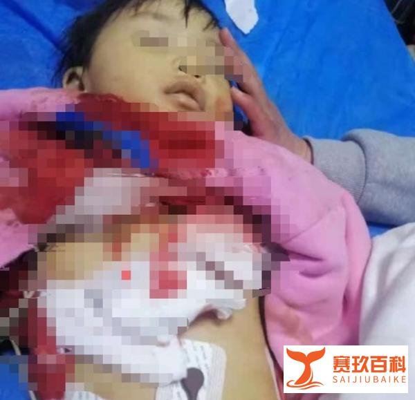 2死1伤的安阳特大事件