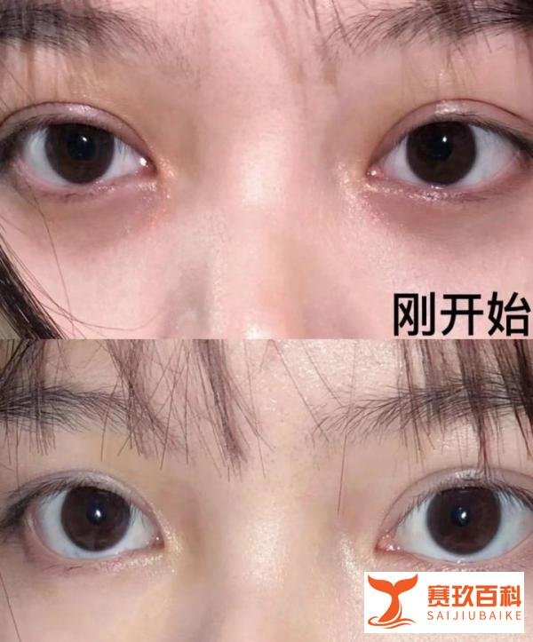 黑眼圈橡皮擦！我的近期护肤空瓶——伊能静同款眼霜有点东西的！