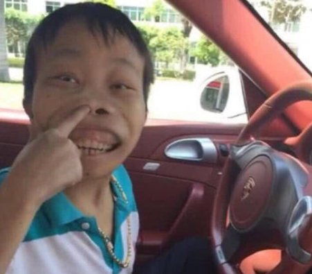 还记得“外星人”陈山吗？封杀3年变化巨大，如今生活过得怎样了？
